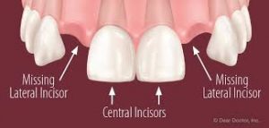 the teeth