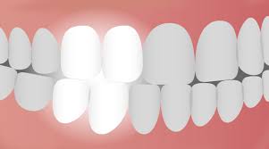 the teeth