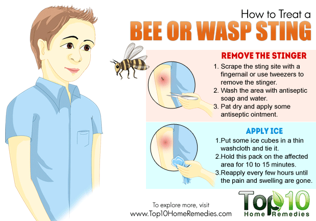 Basic First Aid for Bee Stings basic science classnotesng