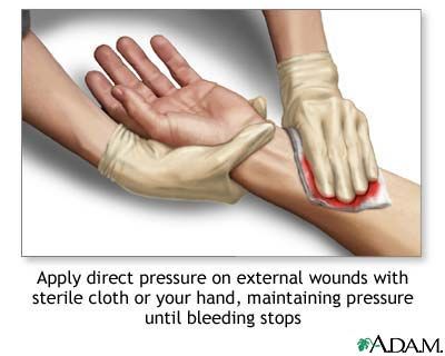 Basic First Aid for Bleeding basic science classnotesng