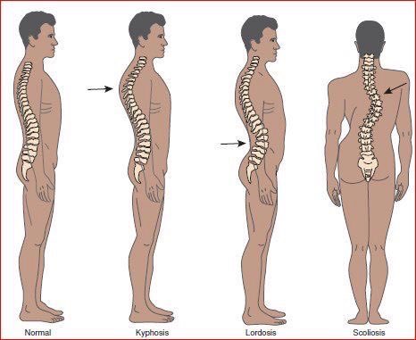 postures phe classnotesng