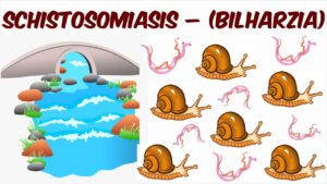 schistosomiasis