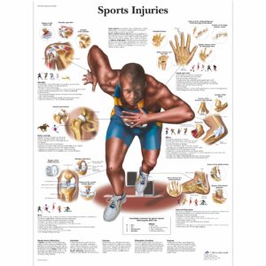 Types of Sport Injuries Continued