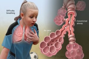 Nature of Asthma, and Anemia as Non- Communicable Diseases