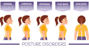 Factors that Influences Correct Postures