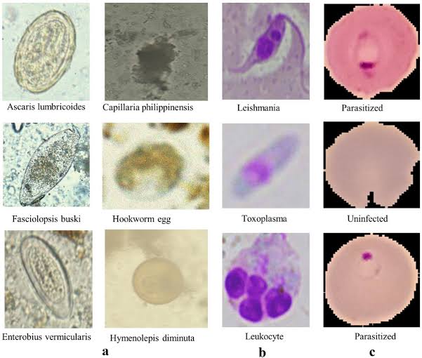 Microscopic Identification Of Parasites Class Notes microscopic-identification-of-parasites-class-notes